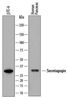 Western Blot Secretagogin Antibody (778518) [Unconjugated]