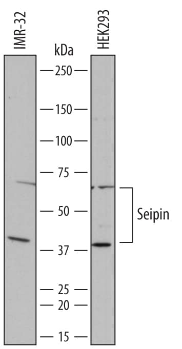 Western Blot Seipin/BSCL2 Antibody