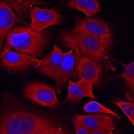 Semaphorin 3C was detected in immersion fixed MCF-7 human breast cancer cell line using Sheep Anti-Mouse Semaphorin 3C Antigen Affinity-purified Polyclonal Antibody (Catalog # AF1728) at 10 µg/mL for 3 hours at room temperature. Cells were stained using the NorthernLights™ 557-conjugated Anti-Sheep IgG Secondary Antibody (red; Catalog # NL010) and counterstained with DAPI (blue). Specific staining was localized to cytoplasm. View our protocol for Fluorescent ICC Staining of Cells on Coverslips.