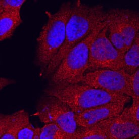 Immunocytochemistry Semaphorin 3C Antibody (238835) [Unconjugated]