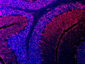 Immunohistochemistry Semaphorin 3E Antibody [Unconjugated]
