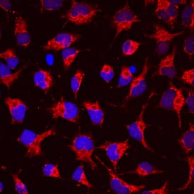 Immunocytochemistry Semaphorin 4C Antibody [Unconjugated]