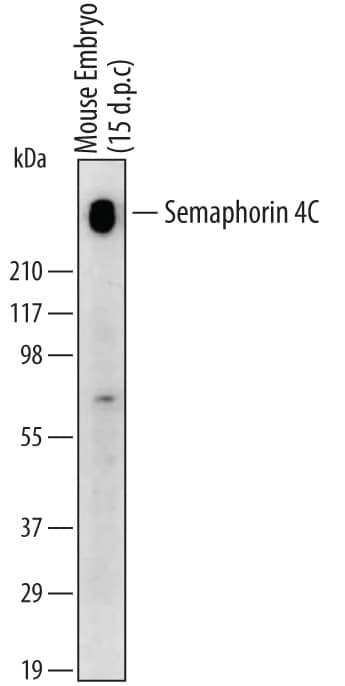 Western Blot Semaphorin 4C Antibody [Unconjugated]