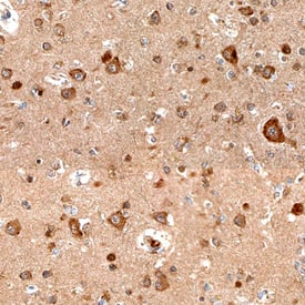 Immunohistochemistry Semaphorin 4C Antibody [Unconjugated]