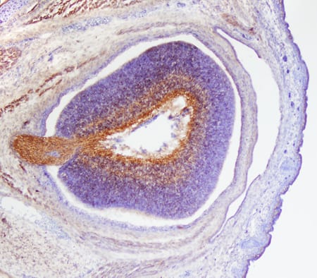 Semaphorin 4D/CD100 was detected in immersion fixed frozen sections of mouse embryonic eye cup (15 d.p.c.) using Sheep Anti-Mouse Semaphorin 4D/CD100 Antigen Affinity-purified Polyclonal Antibody (Catalog # AF5235) at 15 µg/mL overnight at 4 °C. Tissue was stained using the Anti-Sheep HRP-DAB Cell & Tissue Staining Kit (brown; Catalog # CTS019) and counterstained with hematoxylin (blue). Specific staining was localized to cytoplasm. View our protocol for Chromogenic IHC Staining of Frozen Tissue Sections.