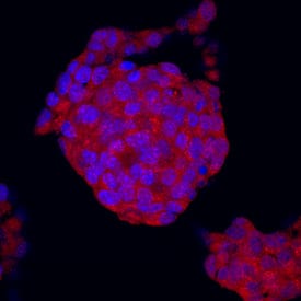 Semaphorin 5A was detected in immersion fixed  beta TC-6 mouse beta cell insulinoma cell line using Sheep Anti-Human/Mouse/Rat Semaphorin 5A Antigen Affinity-purified Polyclonal Antibody (Catalog # AF5896) at 10 µg/mL for 3 hours at room temperature. Cells were stained using the NorthernLights™ 557-conjugated Anti-Sheep IgG Secondary Antibody (red; Catalog # NL010) and counterstained with DAPI (blue). Specific staining was localized to cytoplasm. View our protocol for Fluorescent ICC Staining of Cells on Coverslips.