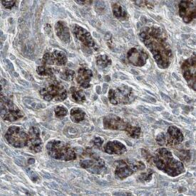 Semaphorin 5A was detected in immersion fixed paraffin-embedded sections of human pancreas using Sheep Anti-Human/Mouse/Rat Semaphorin 5A Antigen Affinity-purified Polyclonal Antibody (Catalog # AF5896) at 5 µg/mL overnight at 4 °C. Tissue was stained using the Anti-Sheep HRP-DAB Cell & Tissue Staining Kit (brown; Catalog # CTS019) and counterstained with hemotoxylin (blue). Specific staining was localized to the plasma membranes of epithelial cells. View our protocol for Chromogenic IHC Staining of Paraffin-embedded Tissue Sections.