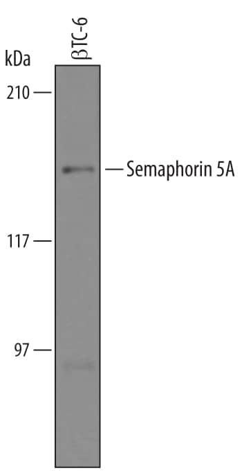 Western blot shows lysates of  beta TC-6 mouse beta cell insulinoma cell line. PVDF Membrane was probed with 1 µg/mL of Sheep Anti-Human/Mouse/Rat Semaphorin 5A Antigen Affinity-purified Polyclonal Antibody (Catalog # AF5896) followed by HRP-conjugated Anti-Sheep IgG Secondary Antibody (Catalog # HAF016). A specific band was detected for Semaphorin 5A at approximately 135 kDa (as indicated). This experiment was conducted under reducing conditions and using Immunoblot Buffer Group 8.