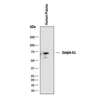 Western blot shows human plasma. PVDF membrane was probed with 0.1 µg/mL of Sheep Anti-Human Serpin A1/a1-Antitrypsin Antigen Affinity-purified Polyclonal Antibody (Catalog # AF12681) followed by HRP-conjugated Anti-Sheep IgG Secondary Antibody (Catalog # HAF016). A specific band was detected for Serpin A1/a1-Antitrypsin at approximately 60 kDa (as indicated). This experiment was conducted under reducing conditions and using Immunoblot Buffer Group 1.