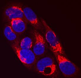 Serpin A1/a1-Antitrypsin was detected in immersion fixed HepG2 human hepatocellular carcinoma cell line using Goat Anti-Human Serpin A1/a1-Antitrypsin Antigen Affinity-purified Polyclonal Antibody (Catalog # AF1268) at 10 µg/mL for 3 hours at room temperature. Cells were stained using the NorthernLights™ 557-conjugated Anti-Goat IgG Secondary Antibody (red; NL001) and counterstained with DAPI (blue). Specific staining was localized to cytoplasm. View our protocol for Fluorescent ICC Staining of Cells on Coverslips.