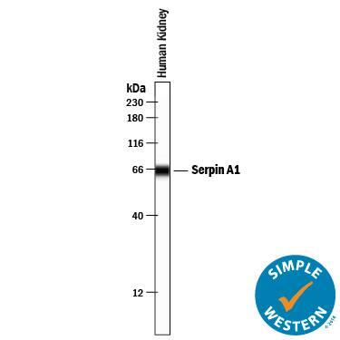 Simple Western lane view shows lysates of human kidney tissue, loaded at 0.2 mg/mL. A specific band was detected for Serpin A1/ alpha 1‑Antitrypsin at approximately 65 kDa (as indicated) using 1 µg/mL of Goat Anti-Human Serpin A1/ alpha 1‑Antitrypsin Antigen Affinity-purified Polyclonal Antibody (Catalog # AF1268) . This experiment was conducted under reducing conditions and using the 12-230 kDa separation system.