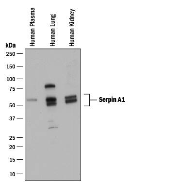 Western blot shows human plasma and lysates of human lung tissue and human kidney tissue. PVDF membrane was probed with 0.1 µg/mL of Goat Anti-Human Serpin A1/a1-Antitrypsin Antigen Affinity-purified Polyclonal Antibody (Catalog # AF1268) followed by HRP-conjugated Anti-Goat IgG Secondary Antibody (HAF017). Specific bands were detected for Serpin A1/a1-Antitrypsin at approximately 50-60 kDa (as indicated). This experiment was conducted under reducing conditions and using Immunoblot Buffer Group 1.