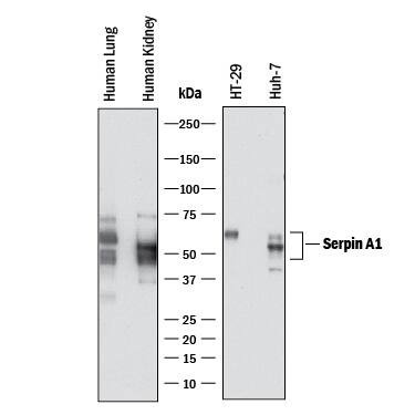 Western blot shows lysates of human lung tissue, human kidney tissue, HT-29 human colon adenocarcinoma cell line, and Huh-7 human hepatoma cell line. PVDF membrane was probed with 2 µg/mL of Mouse Anti-Human Serpin A1/a1-Antitrypsin Monoclonal Antibody (Catalog # MAB12681) followed by HRP-conjugated Anti-Mouse IgG Secondary Antibody (Catalog # HAF018). Specific bands were detected for Serpin A1/a1-Antitrypsin at approximately 45-60 kDa (as indicated). This experiment was conducted under reducing conditions and using Immunoblot Buffer Group 1.