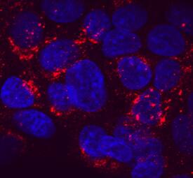 Serpin A1/a1-Antitrypsin was detected in immersion fixed HepG2 human hepatocellular carcinoma cell line using Mouse Anti-Human Serpin A1/ a1-Antitrypsin Monoclonal Antibody (Catalog # MAB1268) at 10 µg/mL for 3 hours at room temperature. Cells were stained using the NorthernLights™ 557-conjugated Anti-Mouse IgG Secondary Antibody (red; NL007) and counter-stained with DAPI (blue). Specific staining was localized to cytoplasm. View our protocol for Fluorescent ICC Staining of Cells on Coverslips.