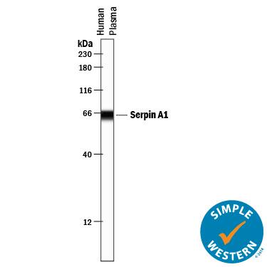 Simple Western lane view shows lysates of human plasma, loaded at 0.2 mg/mL. A specific band was detected for Serpin A1/ alpha 1‑Antitrypsin at approximately 65 kDa (as indicated) using 10 µg/mL of Mouse Anti-Human Serpin A1/ alpha 1‑Antitrypsin Monoclonal Antibody (Catalog # MAB1268) . This experiment was conducted under reducing conditions and using the 12-230 kDa separation system.