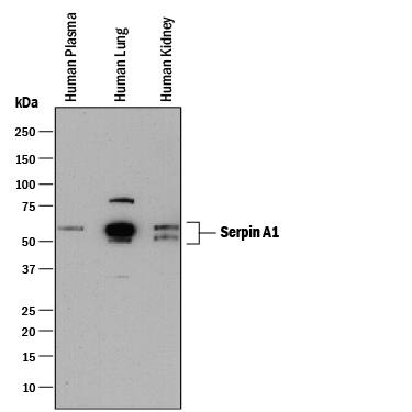 Western blot shows human plasma and lysates of human lung tissue and human kidney tissue. PVDF membrane was probed with 1 µg/mL of Mouse Anti-Human Serpin A1/a1-Antitrypsin Monoclonal Antibody (Catalog # MAB1268) followed by HRP-conjugated Anti-Mouse IgG Secondary Antibody (HAF018). Specific bands were detected for Serpin A1/a1-Antitrypsin at approximately 50-60 kDa (as indicated). This experiment was conducted under reducing conditions and using Immunoblot Buffer Group 1.