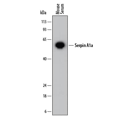 Western blot shows mouse serum. PVDF membrane was probed with 0.2 µg/mL of Rat Anti-Mouse Serpin A1a Monoclonal Antibody (Catalog # MAB7690) followed by HRP-conjugated Anti-Rat IgG Secondary Antibody (Catalog # HAF005). A specific band was detected for Serpin A1a at approximately 50-55 kDa (as indicated). This experiment was conducted under reducing conditions and using Immunoblot Buffer Group 1.