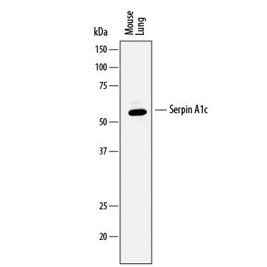 Western blot shows lysates of mouse lung tissue. PVDF membrane was probed with 0.5 µg/mL of Goat Anti-Mouse Serpin A1c/a1-Antitrypsin Antigen Affinity-purified Polyclonal Antibody (Catalog # AF2979) followed by HRP-conjugated Anti-Goat IgG Secondary Antibody (Catalog # HAF017). A specific band was detected for Serpin A1c/a1-Antitrypsin at approximately 55 kDa (as indicated). This experiment was conducted under reducing conditions and using Immunoblot Buffer Group 1.
