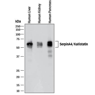 Western blot shows lysates of human liver tissue, human kidney tissue, and human pancreas tissue. PVDF membrane was probed with 0.25 µg/mL of Goat Anti-Human Serpin A4/Kallistatin Antigen Affinity-purified Polyclonal Antibody (Catalog # AF1669) followed by HRP-conjugated Anti-Goat IgG Secondary Antibody (Catalog # HAF017). Specific bands were detected for Serpin A4/Kallistatin at approximately 50-60 kDa (as indicated). This experiment was conducted under reducing conditions and using Immunoblot Buffer Group 1.