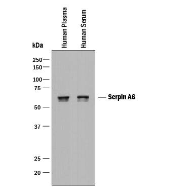 Western blot shows lysates of human plasma and human serum. PVDF membrane was probed with 1 µg/mL of Sheep Anti-Mouse Serpin A6 Antigen Affinity-purified Polyclonal Antibody (Catalog # AF9026) followed by HRP-conjugated Anti-Sheep IgG Secondary Antibody (Catalog # HAF016). A specific band was detected for Serpin A6 at approximately 58 kDa (as indicated). This experiment was conducted under reducing conditions and using Immunoblot Buffer Group 1.