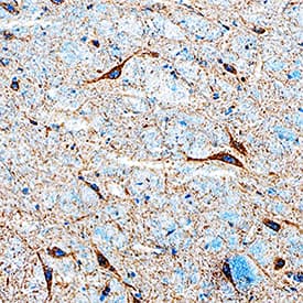 Serpin A6 was detected in perfusion fixed frozen sections of rat brain (preoptic nucleus) using Mouse Anti-Rat Serpin A6 Monoclonal Antibody (Catalog # MAB3838) at 25 µg/mL overnight at 4 °C. Tissue was stained using the Anti-Mouse HRP-DAB Cell & Tissue Staining Kit (brown; Catalog # CTS002) and counterstained with hematoxylin (blue). Specific staining was localized to neurons. View our protocol for Chromogenic IHC Staining of Frozen Tissue Sections.