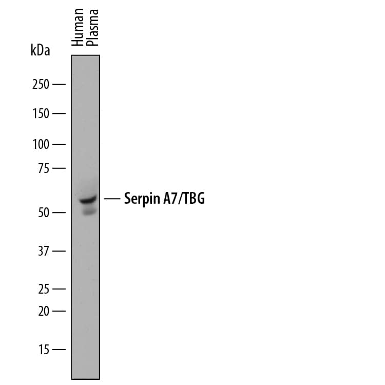 Western blot shows human plasma. PVDF membrane was probed with 1 µg/mL of Sheep Anti-Human Serpin A7/TBG Antigen Affinity-purified Polyclonal Antibody (Catalog # AF8176) followed by HRP-conjugated Anti-Sheep IgG Secondary Antibody (Catalog # HAF016). A specific band was detected for Serpin A7/TBG at approximately 55 kDa (as indicated). This experiment was conducted under reducing conditions and using Immunoblot Buffer Group 1.