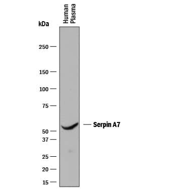 Western blot shows human plasma PVDF membrane was probed with 1 µg/mL of Mouse Anti-Human Serpin A7/TBG Monoclonal Antibody (Catalog # MAB8176) followed by HRP-conjugated Anti-Mouse IgG Secondary Antibody (Catalog # HAF018). A specific band was detected for Serpin A7/TBG at approximately 54 kDa (as indicated). This experiment was conducted under reducing conditions and using Immunoblot Buffer Group 1.