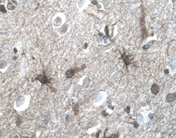 Serpin A8/Angiotensinogen was detected in immersion fixed paraffin-embedded sections of human brain (cortex) using 1.7 µg/mL Goat Anti-Human Serpin A8/Angiotensinogen Antigen Affinity-purified Polyclonal Antibody (Catalog # AF3156) overnight at 4 °C. Tissue was stained with the Anti-Goat HRP-DAB Cell & Tissue Staining Kit (brown; Catalog # CTS008) and counterstained with hematoxylin (blue). View our protocol for Chromogenic IHC Staining of Paraffin-embedded Tissue Sections.