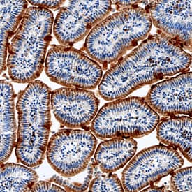 Serpin A8/Angiotensinogen was detected in perfusion fixed frozen sections of mouse intestine using Sheep Anti-Mouse Serpin A8/Angiotensinogen Antigen Affinity-purified Polyclonal Antibody (Catalog # AF6966) at 1.7 µg/mL overnight at 4 °C. Tissue was stained using the Anti-Sheep HRP-DAB Cell & Tissue Staining Kit (brown; Catalog # CTS019) and counterstained with hematoxylin (blue). Specific staining was localized to the brush border in intestinal epithelium. View our protocol for Chromogenic IHC Staining of Frozen Tissue Sections.