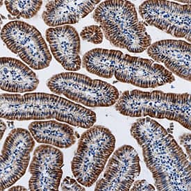 Serpin A8/Angiotensinogen was detected in perfusion fixed frozen sections of mouse intestine using Rat Anti-Mouse Serpin A8/Angiotensinogen Monoclonal Antibody (Catalog # MAB6966) at 5 µg/mL overnight at 4 °C. Tissue was stained using the Anti-Rat HRP-DAB Cell & Tissue Staining Kit (brown; Catalog # CTS017) and counterstained with hematoxylin (blue). Specific staining was localized to intestinal epithelial cells. View our protocol for Chromogenic IHC Staining of Frozen Tissue Sections.
