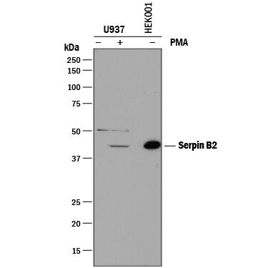 Western blot shows lysates of U937 human histiocytic lymphoma cell line and HEK001 human epidermal keratinocyte cell line untreated (-) or treated (+) with PMA. PVDF membrane was probed with 1:1000 dilution of Rabbit Anti-Human Serpin B2 Antigen Affinity-purified Polyclonal Antibody (Catalog # AF8550) followed by HRP-conjugated Anti-Rabbit IgG Secondary Antibody (Catalog # HAF008). A specific band was detected for Serpin B2 at approximately 47 kDa (as indicated). This experiment was conducted under reducing conditions and using Immunoblot Buffer Group 1.