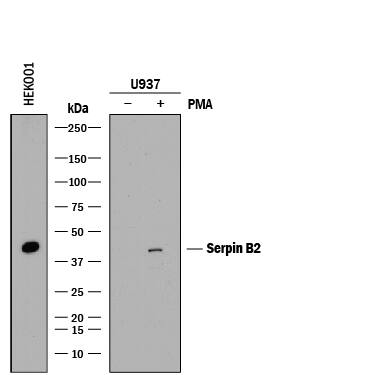 <b>Biological Strategies Validation and Genetic Strategies Validation.</b>Western blot shows lysates of HEK001 human epidermal keratinocyte cell line (untreated) and U937 human histiocytic lymphoma cell line untreated (-) or treated (+) with PMA. PVDF membrane was probed with 0.05 µg/mL of Mouse Anti-Human Serpin B2 Monoclonal Antibody (Catalog # MAB85501) followed by HRP-conjugated Anti-Mouse IgG Secondary Antibody (Catalog # HAF018). A specific band was detected for Serpin B2 at approximately 45 kDa (as indicated). This experiment was conducted under reducing conditions and using Immunoblot Buffer Group 1.