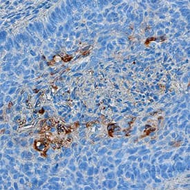 Immunohistochemistry Serpin B3/SCCA1 Antibody (886524) [Unconjugated]