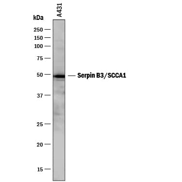 Western Blot Serpin B3/SCCA1 Antibody (886524) [Unconjugated]