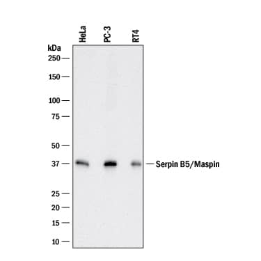 Western blot shows lysates of HeLa human cervical epithelial carcinoma cell line, PC-3 human prostate cancer cell line, and RT-4 human bladder carcinoma cell line. PVDF membrane was probed with 1 µg/mL of Goat Anti-Human Serpin B5/Maspin Antigen Affinity-purified Polyclonal Antibody (Catalog # AF2218) followed by HRP-conjugated Anti-Goat IgG Secondary Antibody (Catalog # HAF017). A specific band was detected for Serpin B5/Maspin at approximately 40 kDa (as indicated). This experiment was conducted under reducing conditions and using Immunoblot Buffer Group 1.