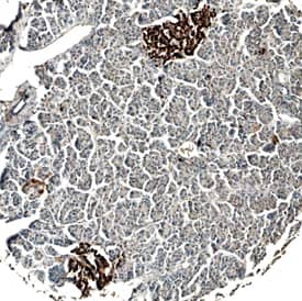 Immunohistochemistry Serpin B8/Proteinase Inhibitor 8 Antibody (423023)