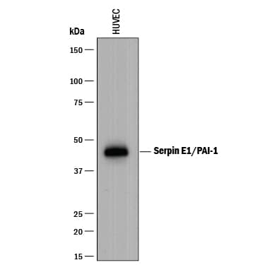 Western blot shows lysates of HUVEC human umbilical vein endothelial cells. PVDF membrane was probed with 1 µg/mL of Goat Anti-Human Serpin E1/PAI-1 Antigen Affinity-purified Polyclonal Antibody (Catalog # AF1786) followed by HRP-conjugated Anti-Goat IgG Secondary Antibody (Catalog # HAF017). A specific band was detected for Serpin E1/PAI-1 at approximately 45 kDa (as indicated). This experiment was conducted under reducing conditions and using Immunoblot Buffer Group 1.