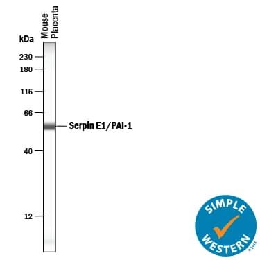 Simple Western lane view shows lysates of mouse placenta tissue, loaded at 0.2 mg/mL. A specific band was detected for Serpin E1/PAI-1 at approximately 56 kDa (as indicated) using 12.5 µg/mL of Goat Anti-Mouse Serpin E1/PAI-1 Antigen Affinity-purified Polyclonal Antibody (Catalog # AF3828) followed by 1:50 dilution of HRP-conjugated Anti-Goat IgG Secondary Antibody (Catalog # HAF109). This experiment was conducted under reducing conditions and using the 12-230 kDa separation system.