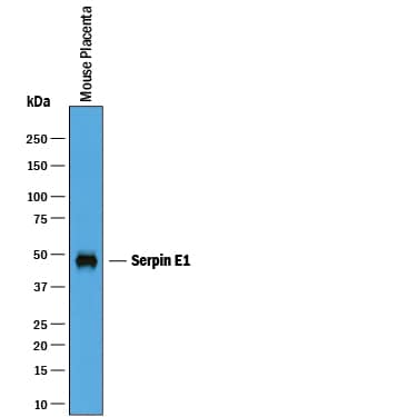 Western blot shows lysates of mouse placenta tissue. PVDF membrane was probed with 0.25 µg/mL of Goat Anti-Mouse Serpin E1/PAI-1 Antigen Affinity-purified Polyclonal Antibody (Catalog # AF3828) followed by HRP-conjugated Anti-Goat IgG Secondary Antibody (Catalog # HAF019). A specific band was detected for Serpin E1/PAI-1 at approximately 45-50 kDa (as indicated). This experiment was conducted under reducing conditions and using Immunoblot Buffer Group 1.