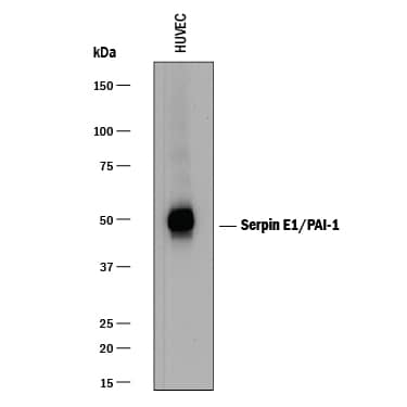 Western blot shows lysates of HUVEC human umbilical vein endothelial cells. PVDF membrane was probed with 1 µg/mL of Goat Anti-Human Serpin E1/PAI-1 Biotinylated Antigen Affinity-purified Polyclonal Antibody (Catalog # BAF1786) followed by Streptavidin-HRP (Catalog # DY998) in 3% BSA. A specific band was detected for Serpin E1/PAI-1 at approximately 48 kDa (as indicated). This experiment was conducted under reducing conditions.