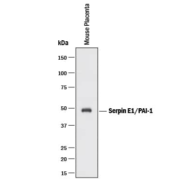Western blot shows lysates of mouse placenta tissue. PVDF membrane was probed with 0.5 µg/mL of Goat Anti-Mouse Serpin E1/PAI-1 Biotinylated Antigen Affinity-purified Polyclonal Antibody (Catalog # BAF3828) followed by Streptavidin-HRP (Catalog # DY998) in 3% BSA. A specific band was detected for Serpin E1/PAI-1 at approximately 48 kDa (as indicated). This experiment was conducted under reducing conditions.