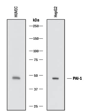 Western blot shows lysates of HUVEC human umbilical vein endothelial cells and HepG2 human hepatocellular carcinoma cell line. PVDF membrane was probed with 0.5 µg/mL of Rabbit Anti-Human Serpin E1/PAI-1 Monoclonal Antibody (Catalog # MAB17861) followed by HRP-conjugated Anti-Rabbit IgG Secondary Antibody (Catalog # HAF008). A specific band was detected for Serpin E1/PAI-1 at approximately 48 kDa (as indicated). This experiment was conducted under reducing conditions and using Immunoblot Buffer Group 1.