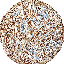 Serpin F1/PEDF was detected in immersion fixed paraffin-embedded sections of human kidney using Goat Anti-Human/Mouse Serpin F1/PEDF Antigen Affinity-purified Polyclonal Antibody (Catalog # AF1177) at 15 µg/mL overnight at 4 °C. Tissue was stained using the Anti-Goat HRP-DAB Cell & Tissue Staining Kit (brown; Catalog # CTS008) and counterstained with hematoxylin (blue). Specific staining was localized to convoluted tubules. View our protocol for Chromogenic IHC Staining of Paraffin-embedded Tissue Sections.