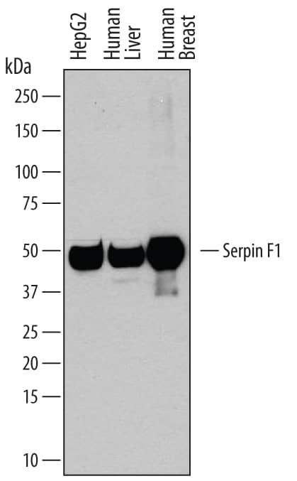 Western blot shows lysates of HepG2 human hepatocellular carcinoma cell line, human liver tissue, and human breast tissue. PVDF membrane was probed with 0.2 µg/mL of Goat Anti-Human/Mouse Serpin F1/PEDF Antigen Affinity-purified Polyclonal Antibody (Catalog # AF1177) followed by HRP-conjugated Anti-Goat IgG Secondary Antibody (Catalog # HAF109). A specific band was detected for Serpin F1/PEDF at approximately 50 kDa (as indicated). This experiment was conducted under reducing conditions and using Immunoblot Buffer Group 1.