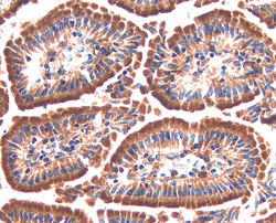 Serpin F2/a2‑Antiplasmin was detected in perfusion fixed frozen sections of mouse intestine using 5 &micro;g/mL Goat Anti-Mouse Serpin F2/a2‑Antiplasmin Antigen Affinity-purified Polyclonal Antibody (Catalog # AF1239) overnight at 4 &deg;C. Tissue was stained with the Anti-Goat HRP-DAB Cell & Tissue Staining Kit (brown; Catalog # CTS008) and counterstained with hematoxylin (blue). View our protocol for Chromogenic IHC Staining of Frozen Tissue Sections.