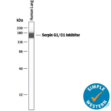 Simple Western lane view shows lysates of human lung tissue, loaded at 0.2 mg/mL. A specific band was detected for Serpin G1/C1 Inhibitor at approximately 162 kDa (as indicated) using 1 µg/mL of Goat Anti-Human Serpin G1/C1 Inhibitor Antigen Affinity-purified Polyclonal Antibody (Catalog # AF2488) followed by 1:50 dilution of HRP-conjugated Anti-Goat IgG Secondary Antibody (Catalog # HAF109). This experiment was conducted under reducing conditions and using the 12-230 kDa separation system.