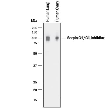 Western blot shows lysates of human lung tissue and human ovary tissue. PVDF membrane was probed with 0.1 µg/mL of Goat Anti-Human Serpin G1/C1 Inhibitor Antigen Affinity-purified Polyclonal Antibody (Catalog # AF2488) followed by HRP-conjugated Anti-Goat IgG Secondary Antibody (Catalog # HAF017). A specific band was detected for Serpin G1/C1 Inhibitor at approximately 100 kDa (as indicated). This experiment was conducted under reducing conditions and using Immunoblot Buffer Group 1.