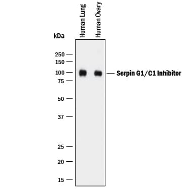 Western blot shows lysates of human lung tissue and human ovary tissue. PVDF membrane was probed with 1 µg/mL of Mouse Anti-Human Serpin G1/C1 Inhibitor Monoclonal Antibody (Catalog # MAB2488) followed by HRP-conjugated Anti-Mouse IgG Secondary Antibody (Catalog # HAF018). A specific band was detected for Serpin G1/C1 Inhibitor at approximately 100 kDa (as indicated). This experiment was conducted under reducing conditions and using Immunoblot Buffer Group 1.