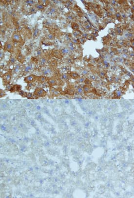 Immunohistochemistry Serum Amyloid A1/A2 Antibody [Unconjugated]