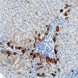Serum Amyloid A1 was detected in immersion fixed paraffin-embedded sections of human liver using Mouse Anti-Human Serum Amyloid A1 Monoclonal Antibody (Catalog # MAB30191) at 1 µg/mL overnight at 4 °C. Tissue was stained using the Anti-Mouse HRP-DAB Cell & Tissue Staining Kit (brown; Catalog # CTS002) and counterstained with hematoxylin (blue). Specific staining was localized to hepatocytes. View our protocol for Chromogenic IHC Staining of Paraffin-embedded Tissue Sections.